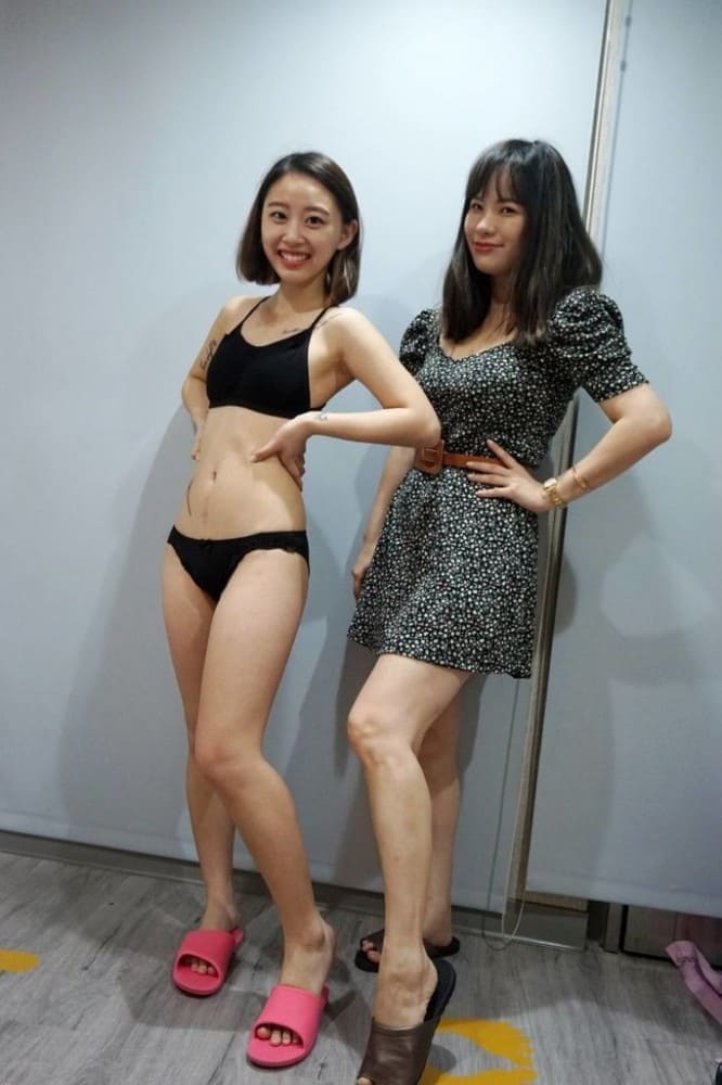 大小腿抽脂,大腿抽脂,小腿抽脂,馬鞍肉抽脂,抽脂手術,李岳樺醫師,博恩妍